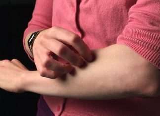 Home Remedies for Ringworm to Cure the Infection Gradually home remedies for ringworm
