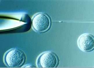 Somatic Cell Nuclear Transfer: All You Should Know Somatic Cell Nuclear Transfer